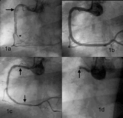 Ernesto Guevara Cardio Center in Santa Clara, Villa Clara, Cuba, just performed its 1,000th angioplasty